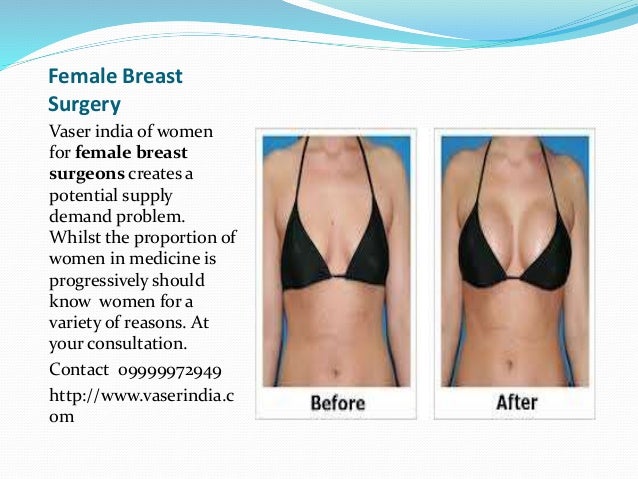 vaser breast reduction Inocent handjob tube